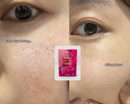 Collagen 15000mg Nhật Bản - Collagen tốt lành & tiết kiệm