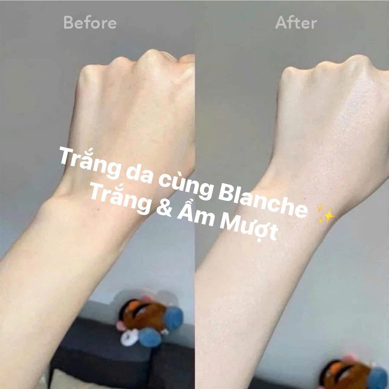 20 ngày sử dụng kem ủ Blanche